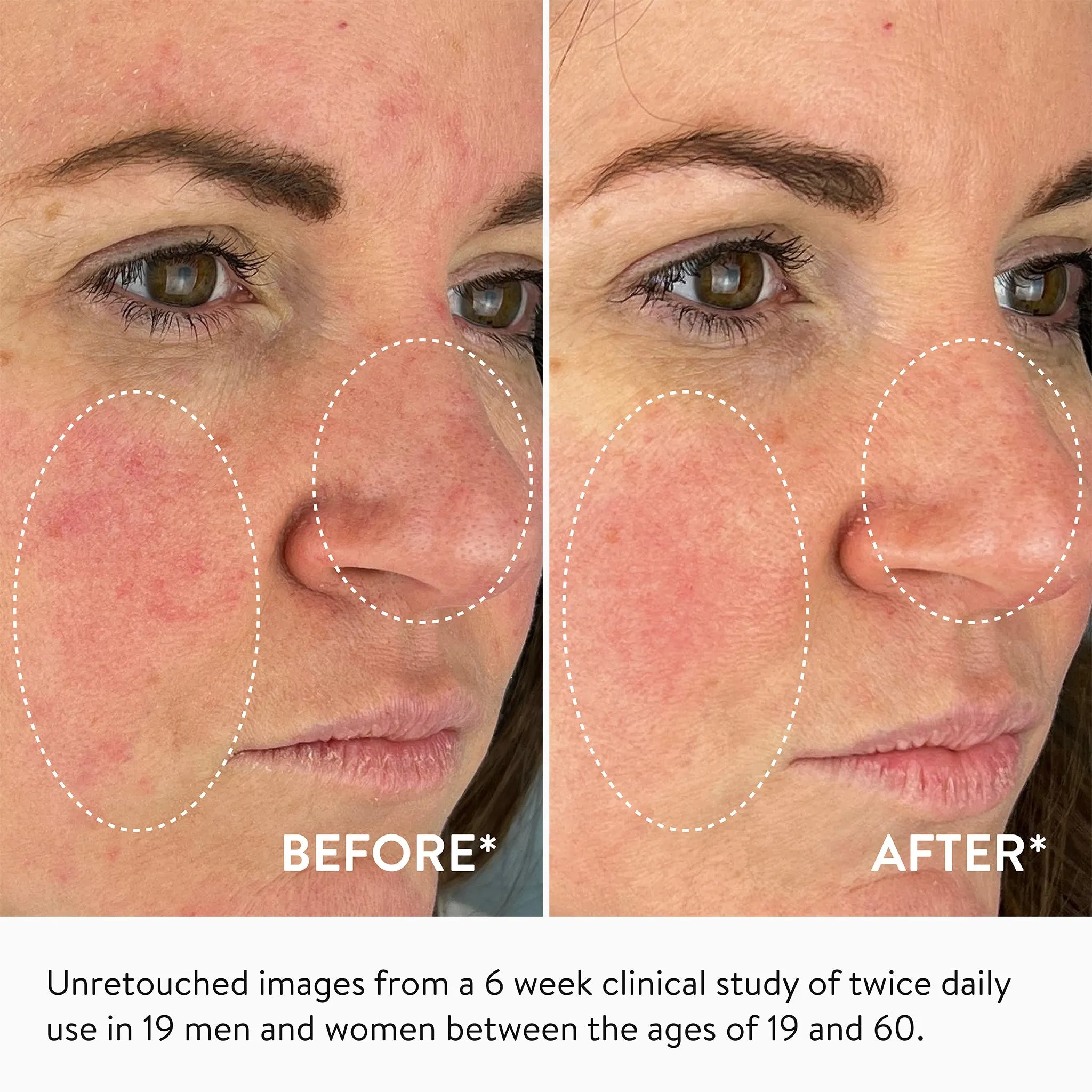 Youth-Boost Peptide Serum